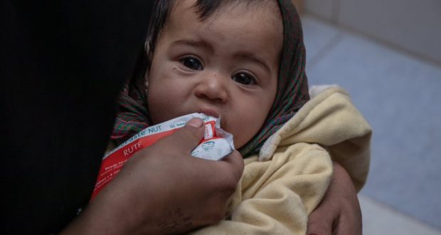 فقر و گرسنگی؛ عوامل اصلی ابتلای کودکان و مادران به سوء تغذیه