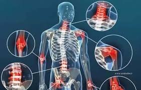 سرد شدن هوا و درد های مفصلی و شخی عضلات (روماتیزم )