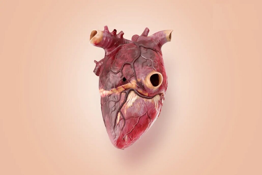بیماری سوراخ قلب؛ چالش شایع در میان کودکان و تلاش هلال‌ احمر برای درمان